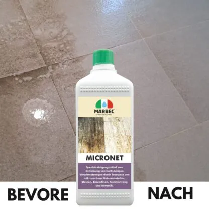 MICRONET